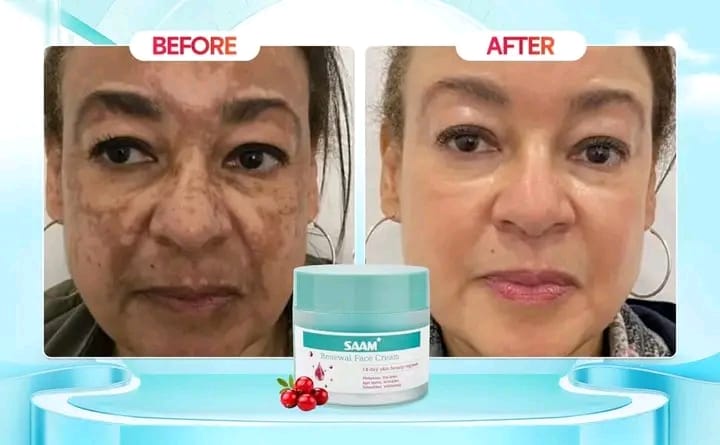 PACK OF 2 Saam Renewal Face Cream    كريم سام لتجديد البشرة